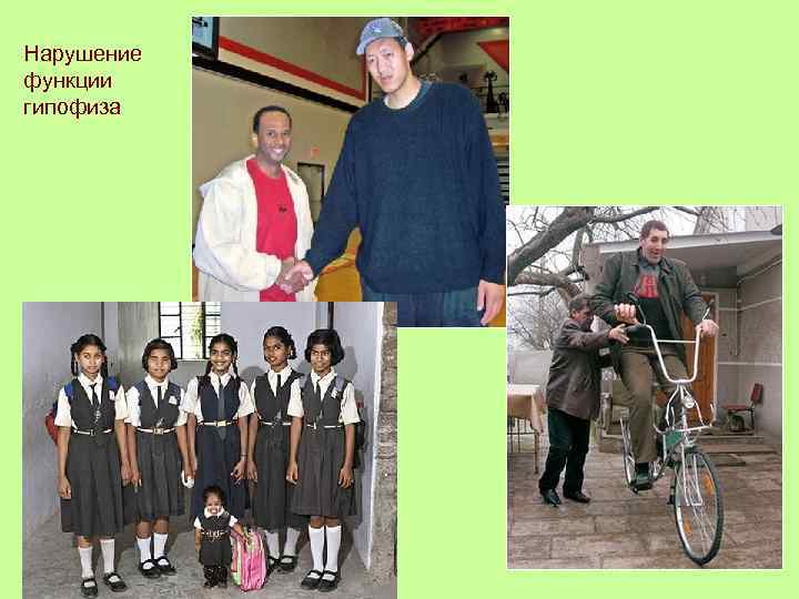 Нарушение функции гипофиза 