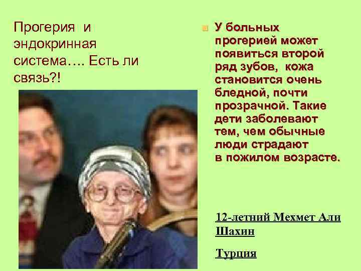 Прогерия и эндокринная система…. Есть ли связь? ! n У больных прогерией может появиться