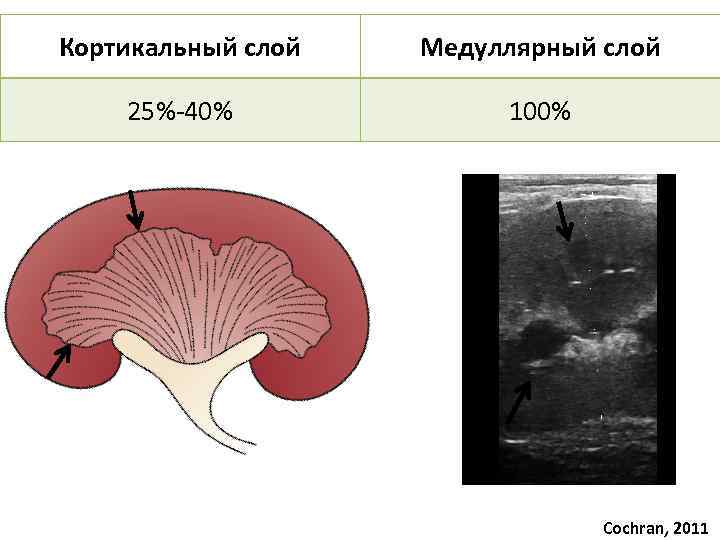 Кортикальный слой Медуллярный слой 25%-40% 100% Cochran, 2011 