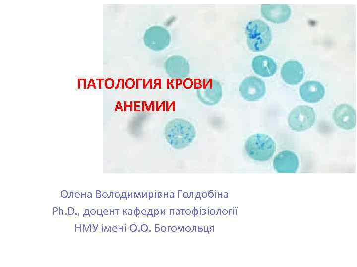 ПАТОЛОГИЯ КРОВИ АНЕМИИ Олена Володимирівна Голдобіна Ph. D. , доцент кафедри патофізіології НМУ імені