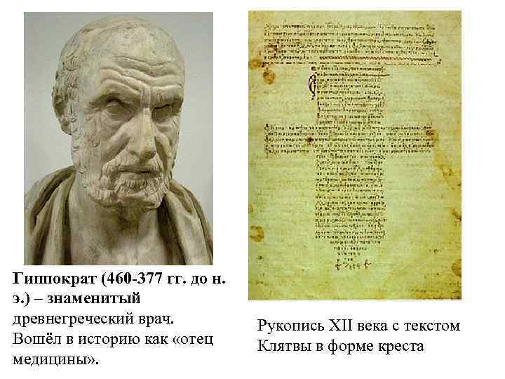 Гиппократ (460 -377 гг. до н. э. ) – знаменитый древнегреческий врач. Вошёл в