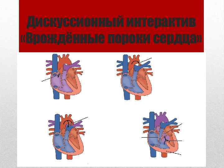 Дискуссионный интерактив «Врождённые пороки сердца» ? ? ? ? 