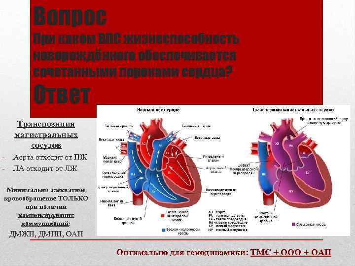 Вопрос При каком ВПС жизнеспособность новорождённого обеспечивается сочетанными пороками сердца? Ответ Транспозиция магистральных сосудов