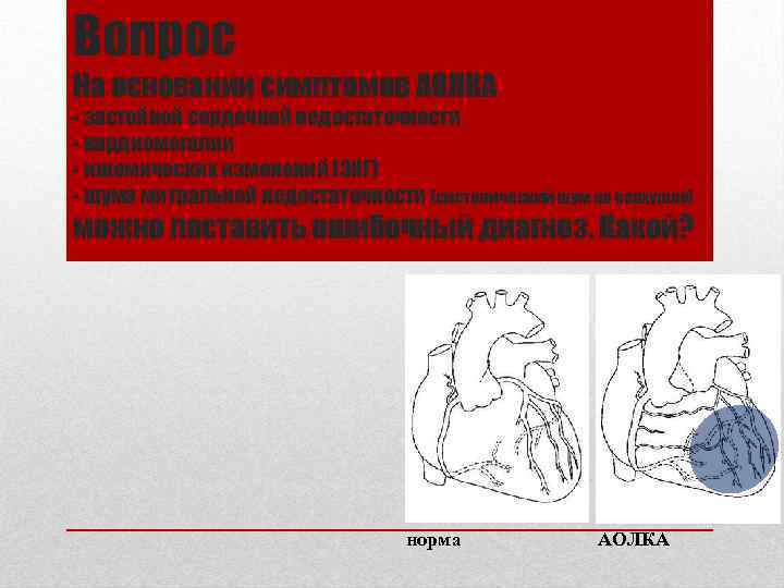Вопрос На основании симптомов АОЛКА - застойной сердечной недостаточности - кардиомегалии - ишемических изменений