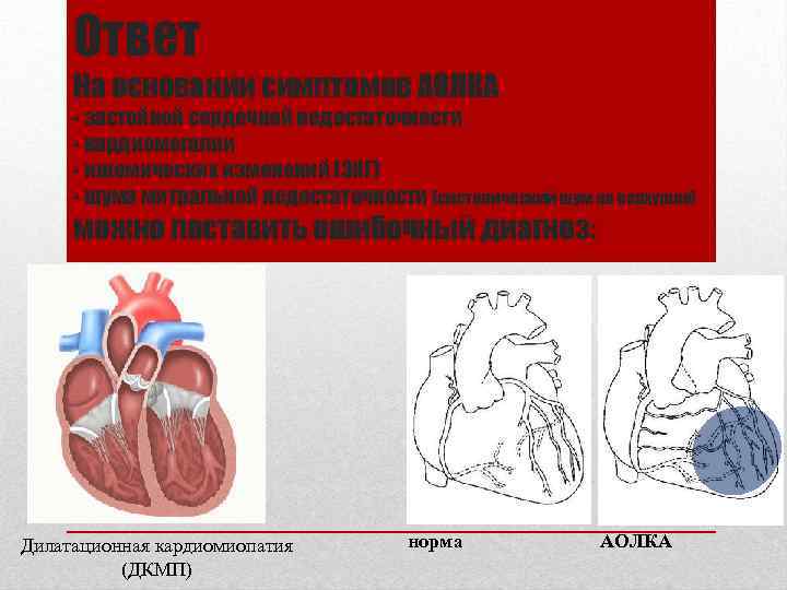 Ответ На основании симптомов АОЛКА - застойной сердечной недостаточности - кардиомегалии - ишемических изменений