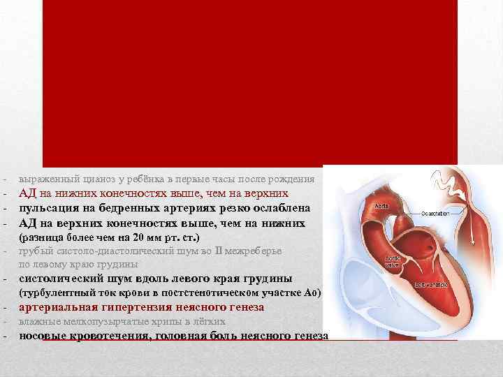 - выраженный цианоз у ребёнка в первые часы после рождения - АД на нижних
