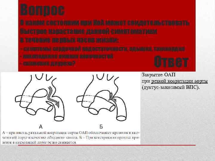 Вопрос О каком состоянии при Ко. А может свидетельствовать быстрое нарастание данной симптоматики в