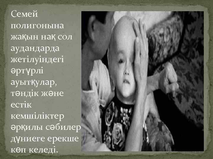Семей полигонына жақын нақ сол аудандарда жетілуіндегі әртүрлі ауытқулар, тәндік және естік кемшіліктер әрқилы