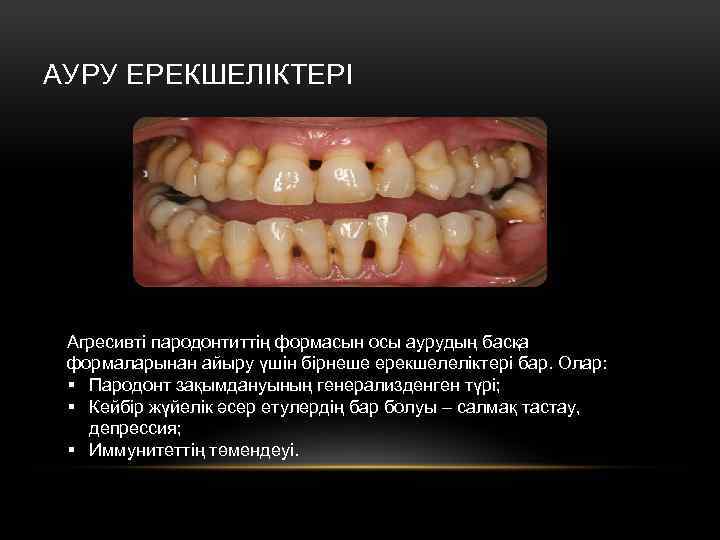 АУРУ ЕРЕКШЕЛІКТЕРІ Агресивті пародонтиттің формасын осы аурудың басқа формаларынан айыру үшін бірнеше ерекшелеліктері бар.