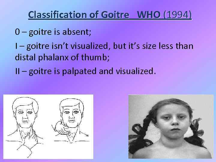 Classification of Goitre WHO (1994) 0 – goitre is absent; I – goitre isn’t