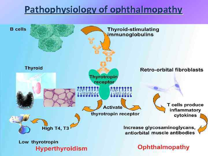 Pathophysiology of ophthalmopathy 