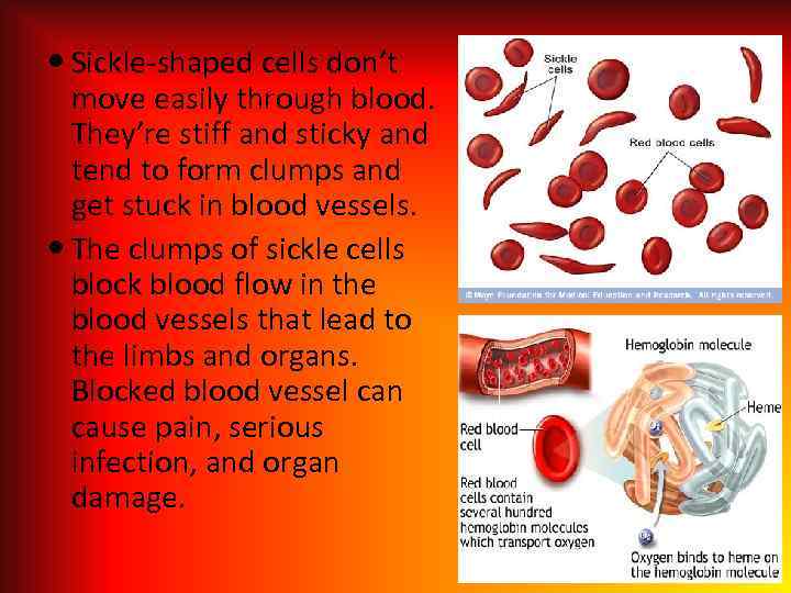  Sickle-shaped cells don’t move easily through blood. They’re stiff and sticky and tend