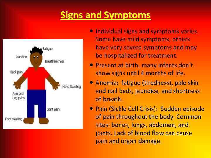 Signs and Symptoms Individual signs and symptoms varies. Some have mild symptoms, others have