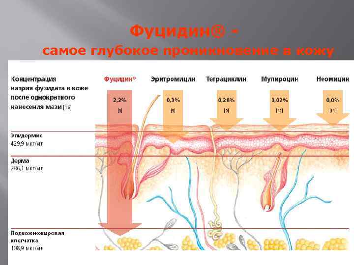 Фуцидин® - самое глубокое проникновение в кожу 