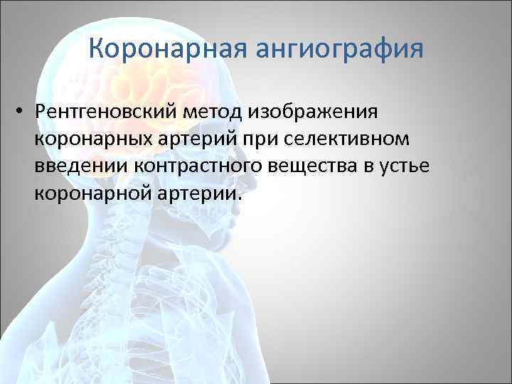 Коронарная ангиография • Рентгеновский метод изображения коронарных артерий при селективном введении контрастного вещества в