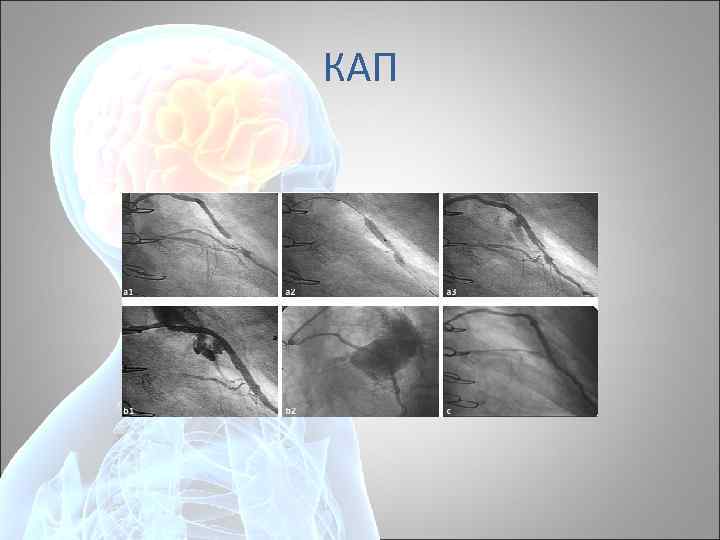 КАП 