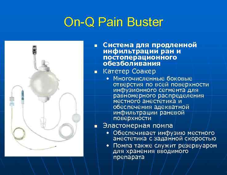 On-Q Pain Buster n n Система для продленной инфильтрации ран и постоперационного обезболивания Катетер