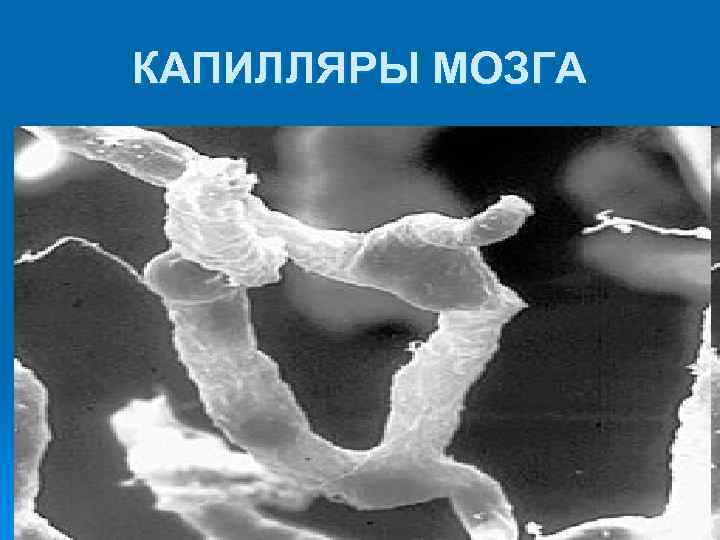 КАПИЛЛЯРЫ МОЗГА 