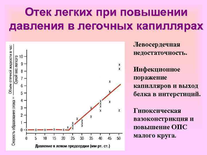 Отек легких при повышении давления в легочных капиллярах Левосердечная недостаточность. Инфекционное поражение капилляров и