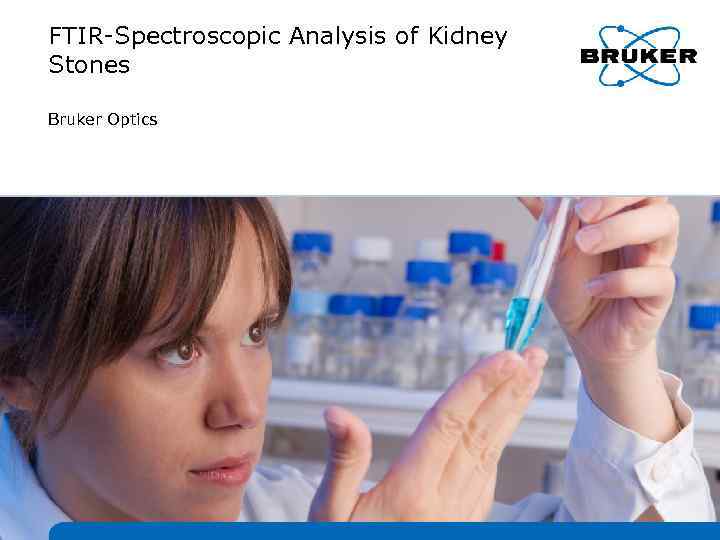 FTIR-Spectroscopic Analysis of Kidney Stones Bruker Optics 