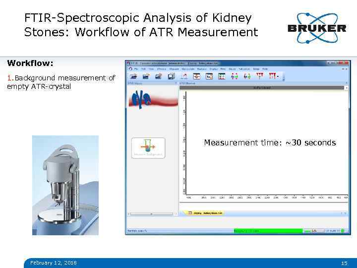 FTIR-Spectroscopic Analysis of Kidney Stones: Workflow of ATR Measurement Workflow: 1. Background measurement of