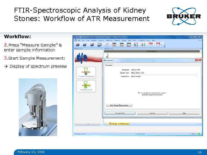 FTIR-Spectroscopic Analysis of Kidney Stones: Workflow of ATR Measurement Workflow: 2. Press “Measure Sample”
