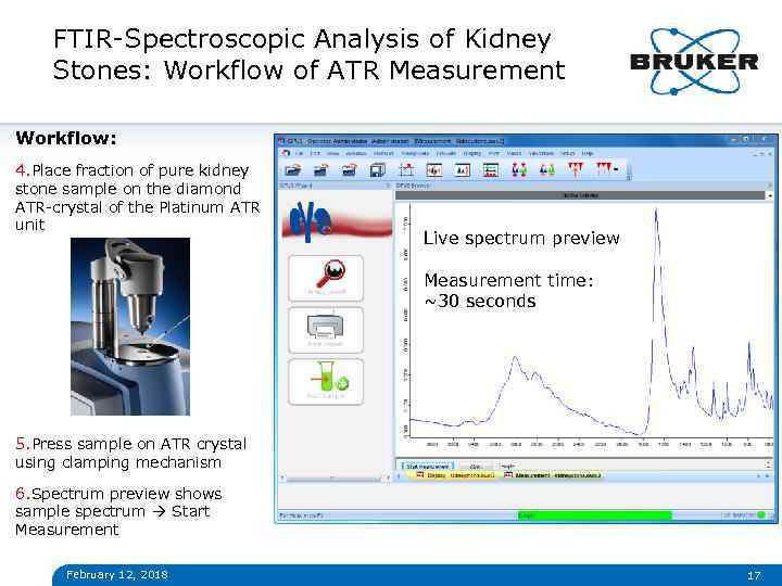 FTIR-Spectroscopic Analysis of Kidney Stones: Workflow of ATR Measurement Workflow: 4. Place fraction of