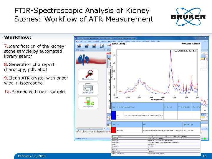 FTIR-Spectroscopic Analysis of Kidney Stones: Workflow of ATR Measurement Workflow: 7. Identification of the