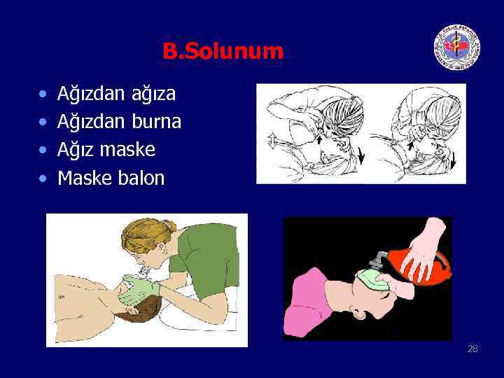 B. Solunum • • Ağızdan ağıza Ağızdan burna Ağız maske Maske balon 28 