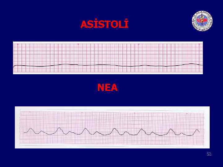 ASİSTOLİ NEA 53 