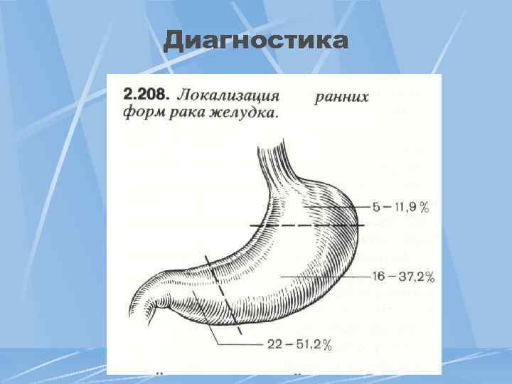 Диагностика 