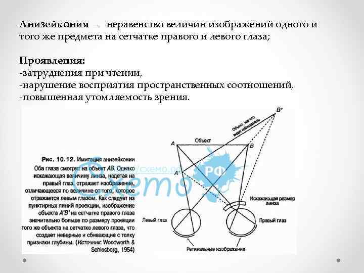 Неравенство величин изображения одного и того же предмета на сетчатке