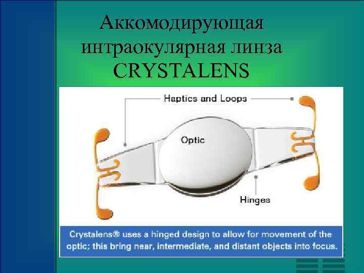Аккомодирующая интраокулярная линза CRYSTALENS 