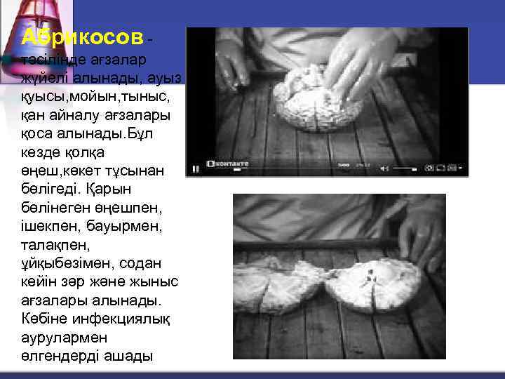 Абрикосов тәсілінде ағзалар жүйелі алынады, ауыз қуысы, мойын, тыныс, қан айналу ағзалары қоса алынады.