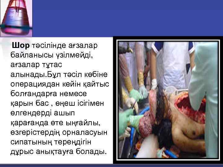 Шор тәсілінде ағзалар байланысы үзілмейді, ағзалар тұтас алынады. Бұл тәсіл көбіне операциядан кейін қайтыс