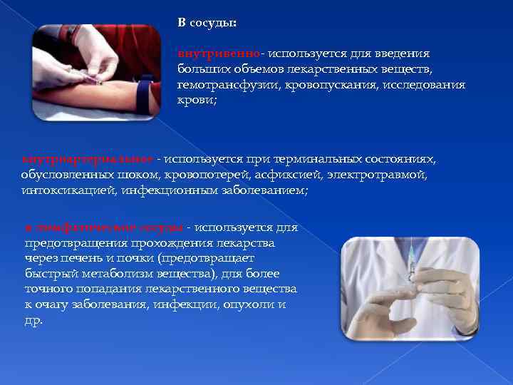 В сосуды: внутривенно- используется для введения больших объемов лекарственных веществ, гемотрансфузии, кровопускания, исследования крови;