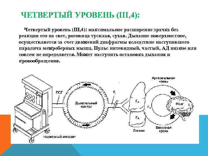 ЧЕТВЕРТЫЙ УРОВЕНЬ (III, 4): Четвертый уровень (III, 4): максимальное расширение зрачка без реакции его