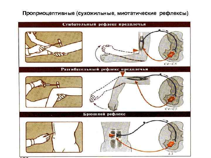 Схема сухожильного рефлекса