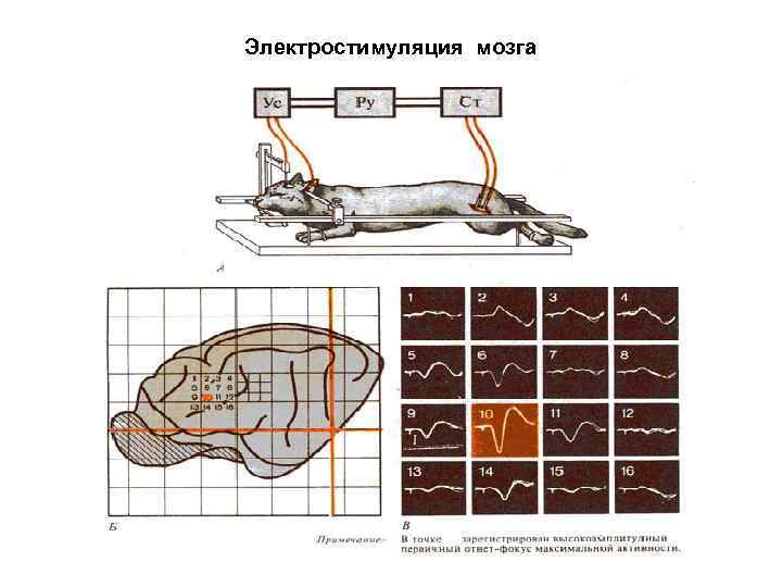 Электростимуляция мозга 