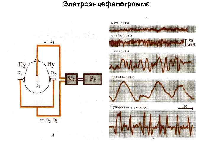 Элетроэнцефалограмма 