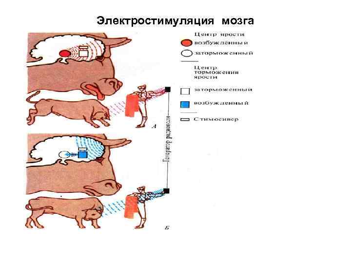 Электростимуляция мозга 