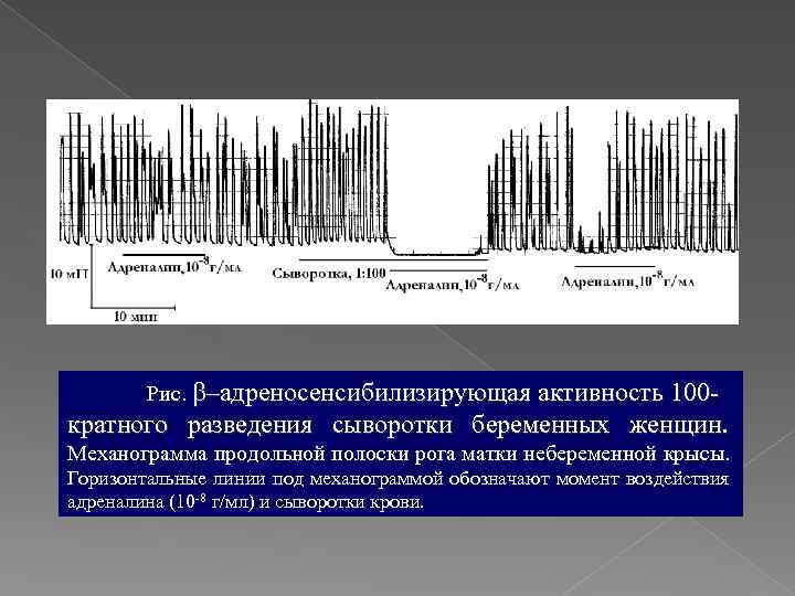 Рис. –адреносенсибилизирующая активность 100 - кратного разведения сыворотки беременных женщин. Механограмма продольной полоски рога