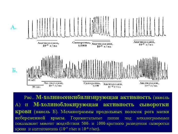 А. Б. М-холиносенсибилизирующая активность (панель А) и М-холиноблокирующая активность сыворотки крови (панель Б). Механограммы