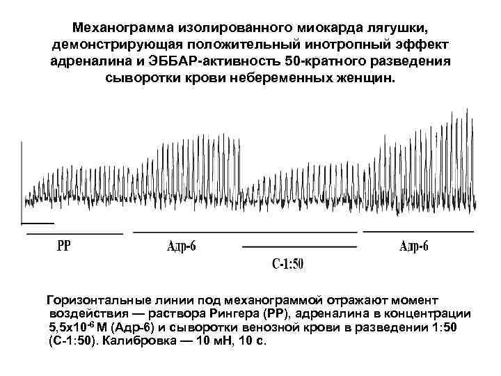 Механограмма изолированного миокарда лягушки, демонстрирующая положительный инотропный эффект адреналина и ЭББАР-активность 50 -кратного разведения