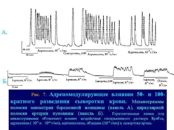 А. Б. Адреномодулирующее влияние 50 - и 100 кратного разведения сыворотки крови. Механограммы Рис.