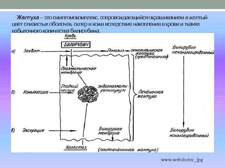 Желтуха – это симптомокомплекс, сопровождающийся окрашиванием в желтый цвет слизистых оболочек, склер и кожи