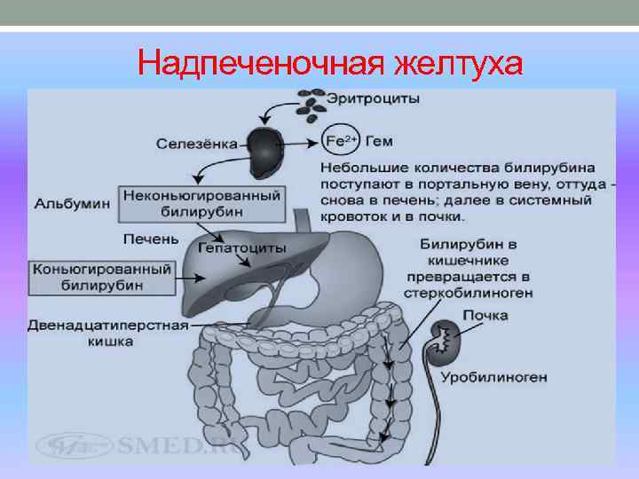  Надпеченочная желтуха 