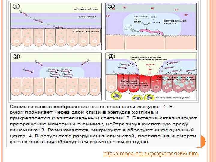 http: //drnona-net. ru/programs/1355. html 