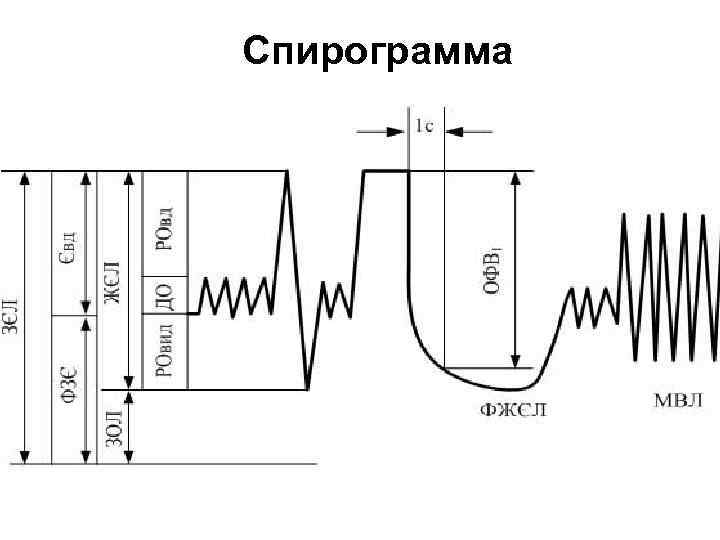 Спирограмма 