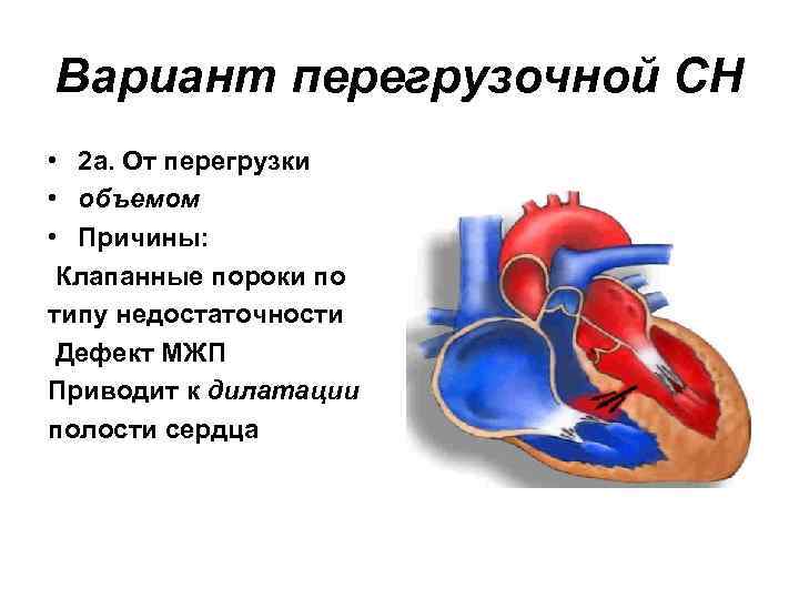 Вариант перегрузочной СН • 2 а. От перегрузки • объемом • Причины: Клапанные пороки